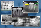 Dental X-Ray Software